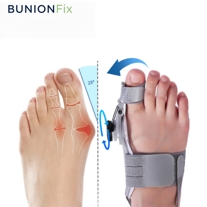 BunionFix Başparmak Düzeltici